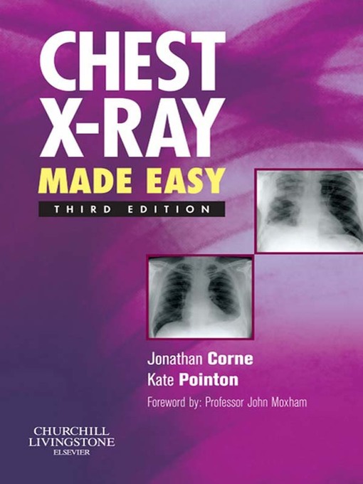Title details for Chest X-Ray Made Easy E-Book by Jonathan Corne - Available